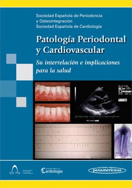 PATOLOGIA PERIODONTAL Y CARDIOVASCULAR SU INTERRELACION E IMPLICACIONES PARA LA SALUD